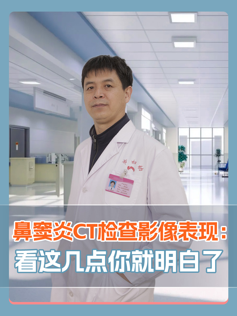 鼻窦炎CT检查影像表现：看这几点你就明白了