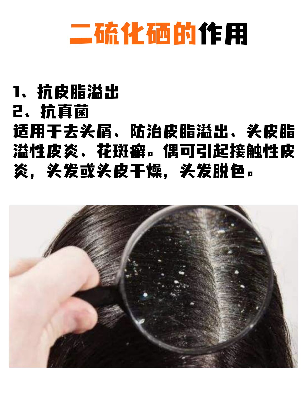 头油就用二硫化硒洗发水？这些知识你得了解