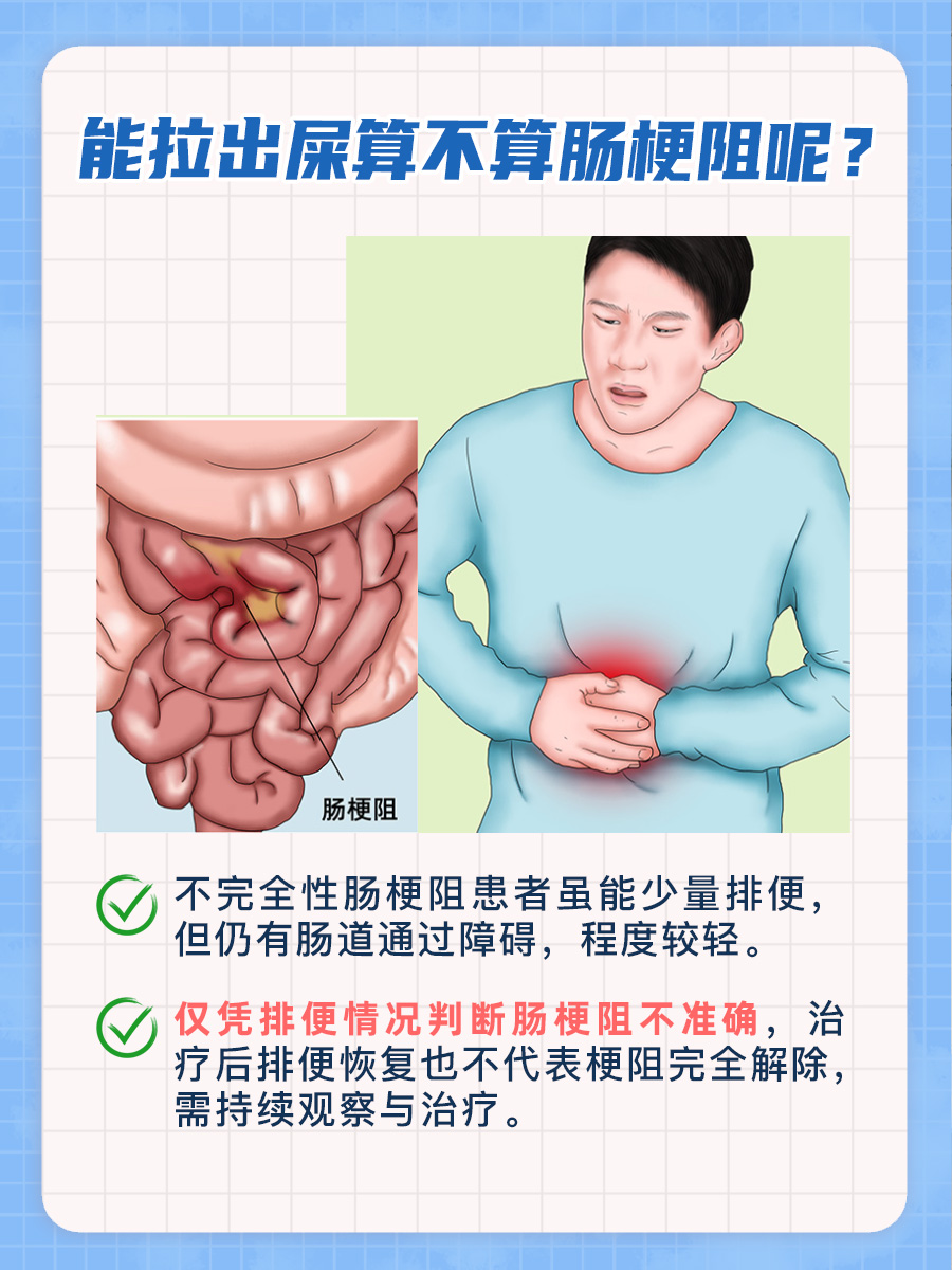 肠梗阻？看排便情况就知一二！