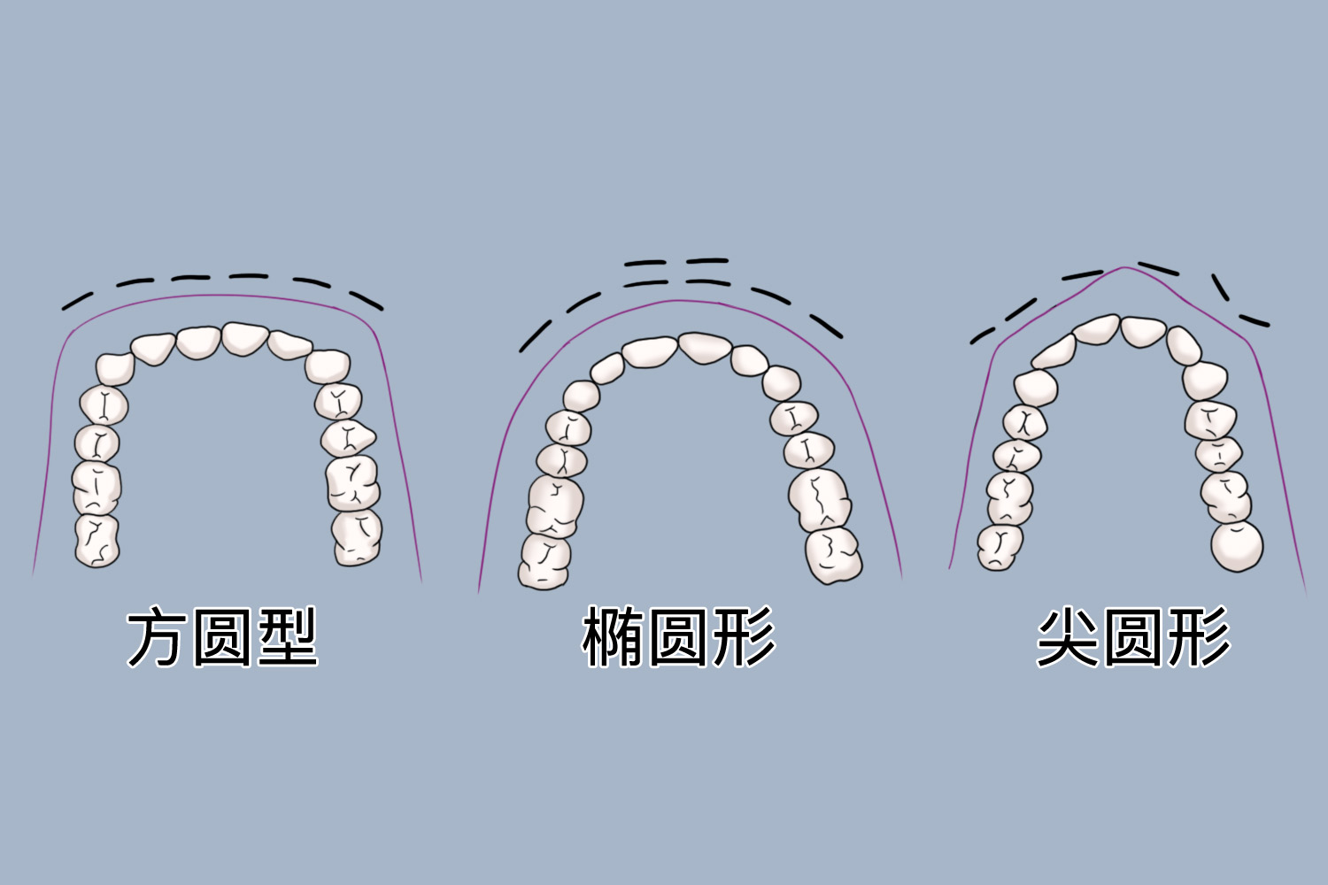 正常上牙弧度图