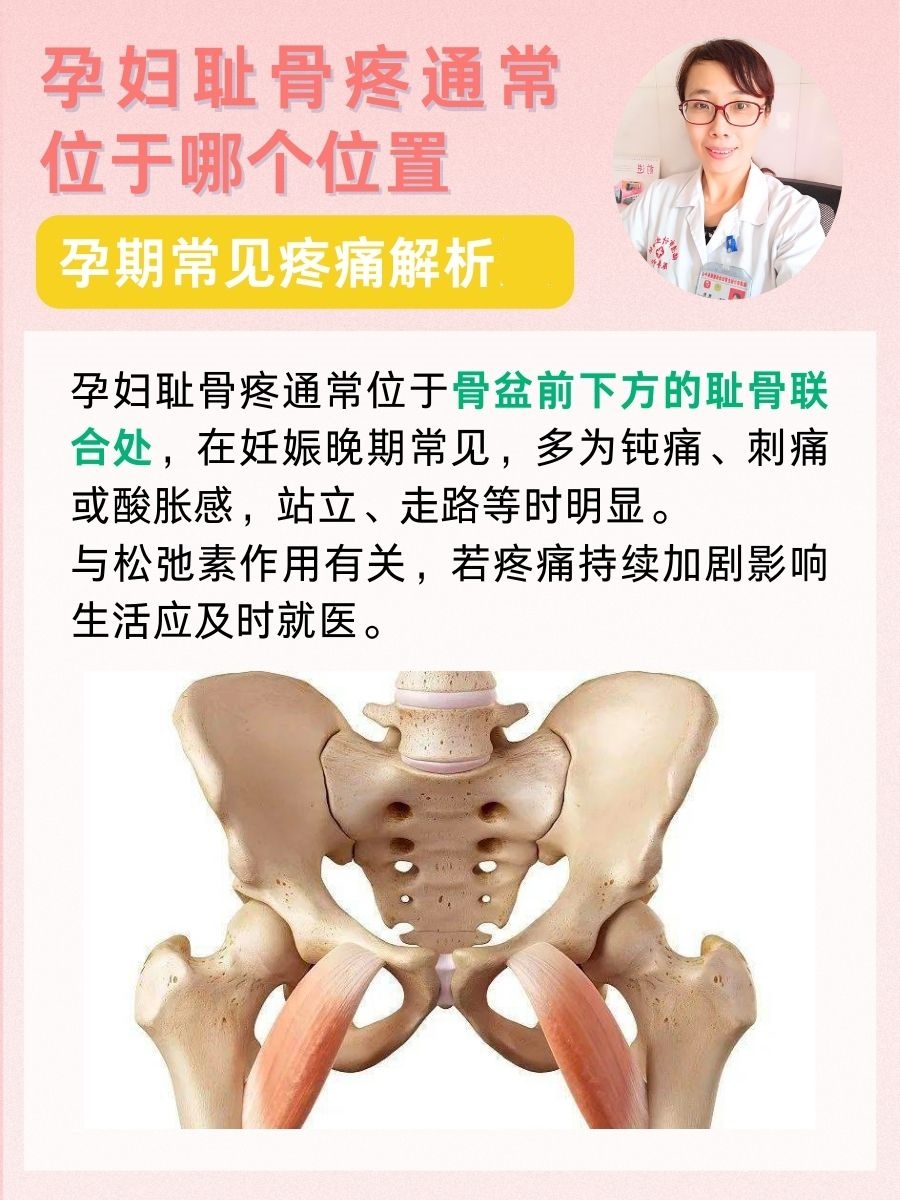 孕妇耻骨疼通常位于哪个位置？孕期常见疼痛解析