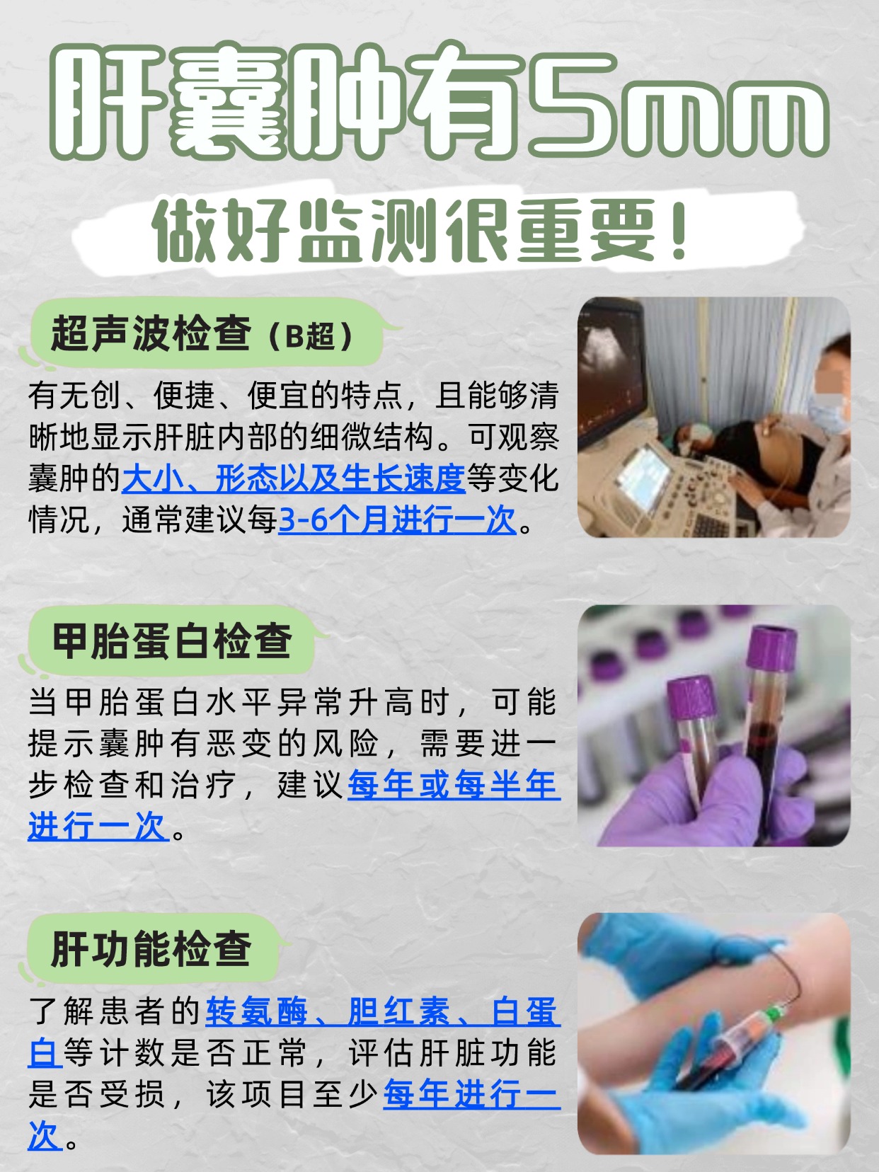 速看!肝囊肿有5mm,生存期还有多久?