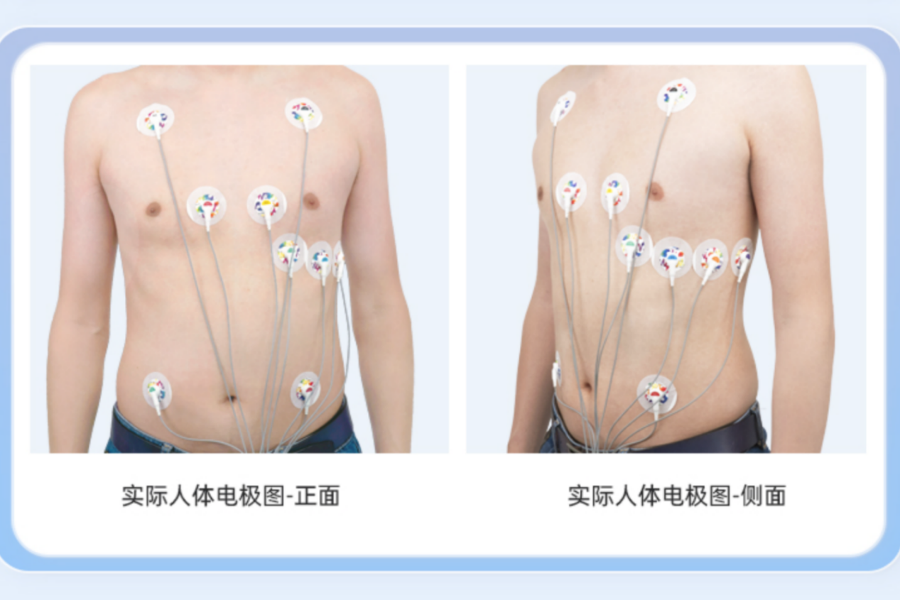 动态心电图佩戴图