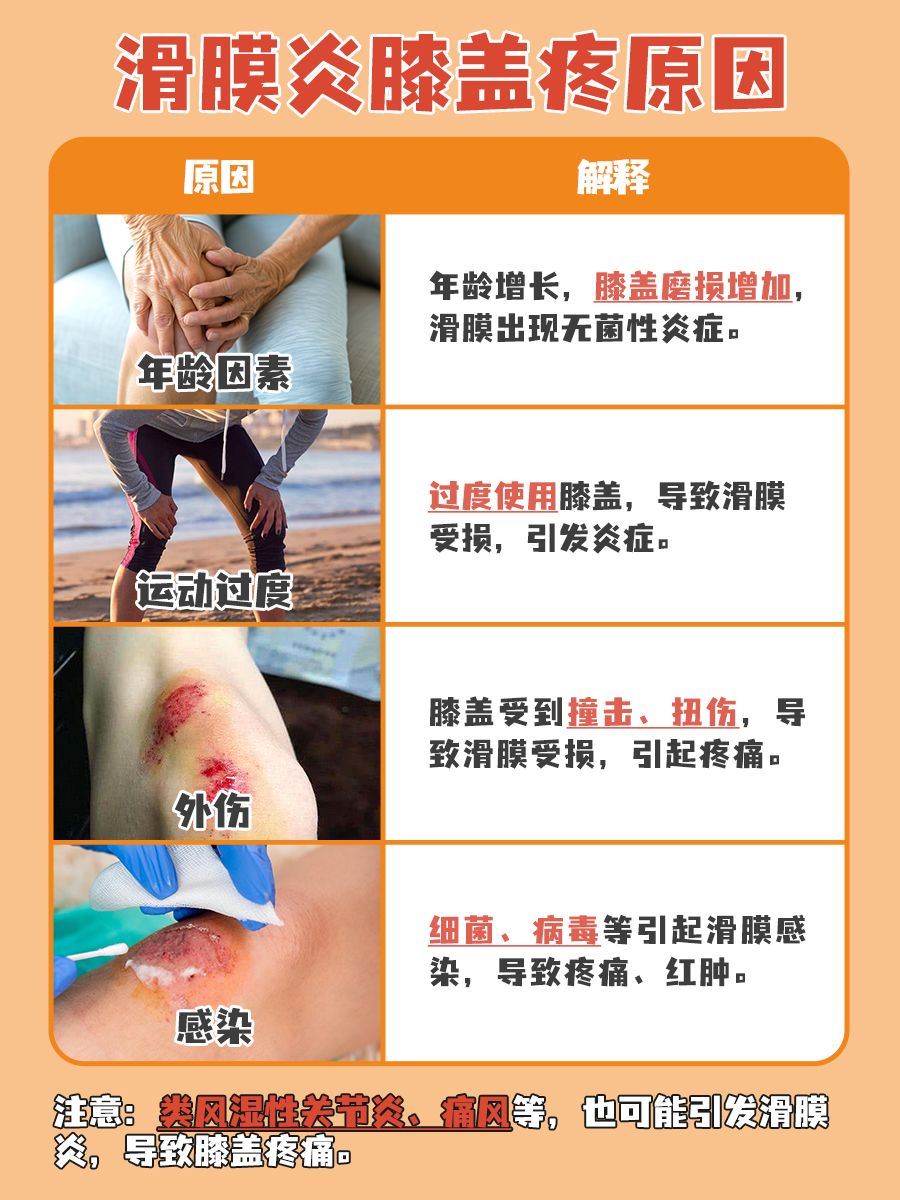 滑膜炎膝盖疼来袭？原因找到了！