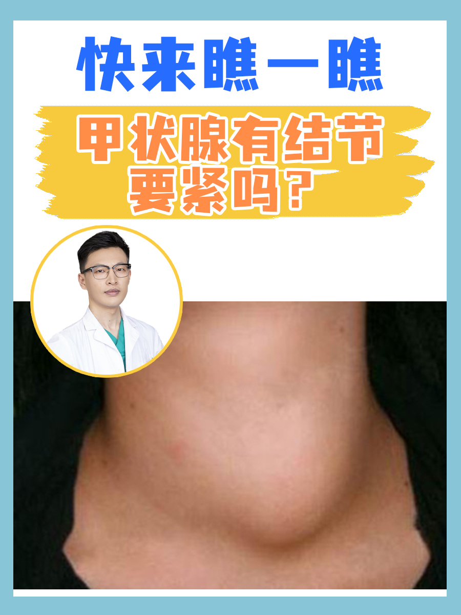 甲状腺有结节要紧吗?快来瞧一瞧