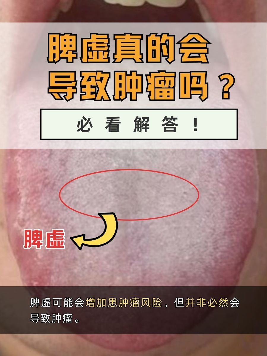 脾虚真的会导致肿瘤吗?必看解答!