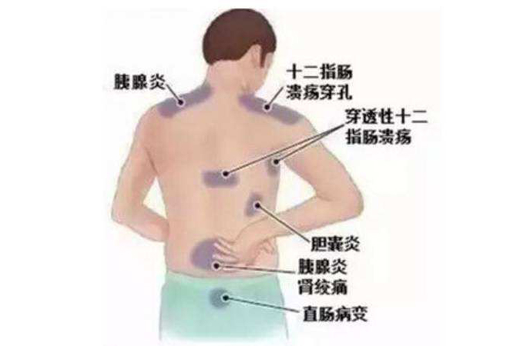 内脏器官疼痛对应背部位置图