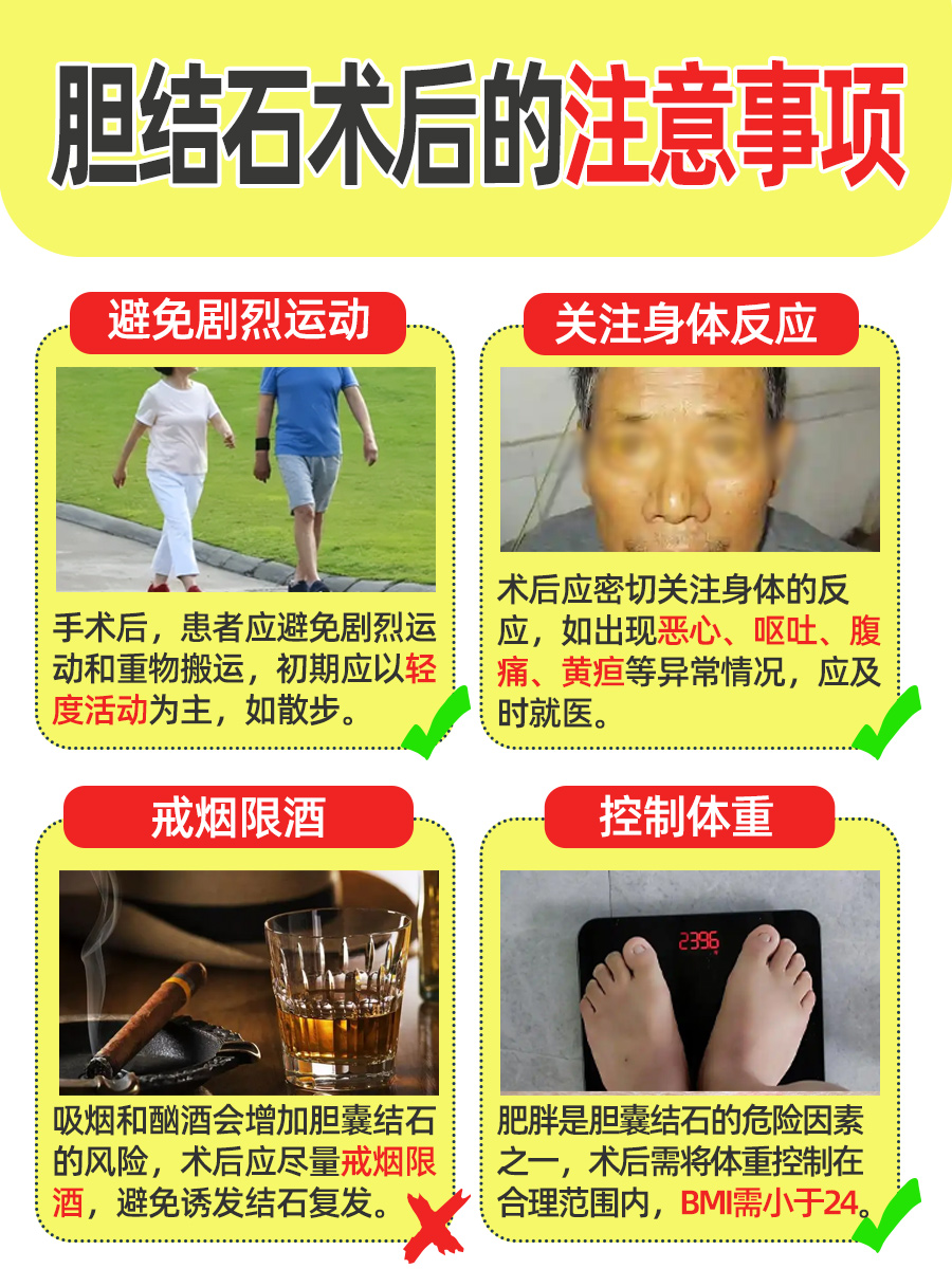 榴莲爱好者注意!胆结石术后能吃吗?