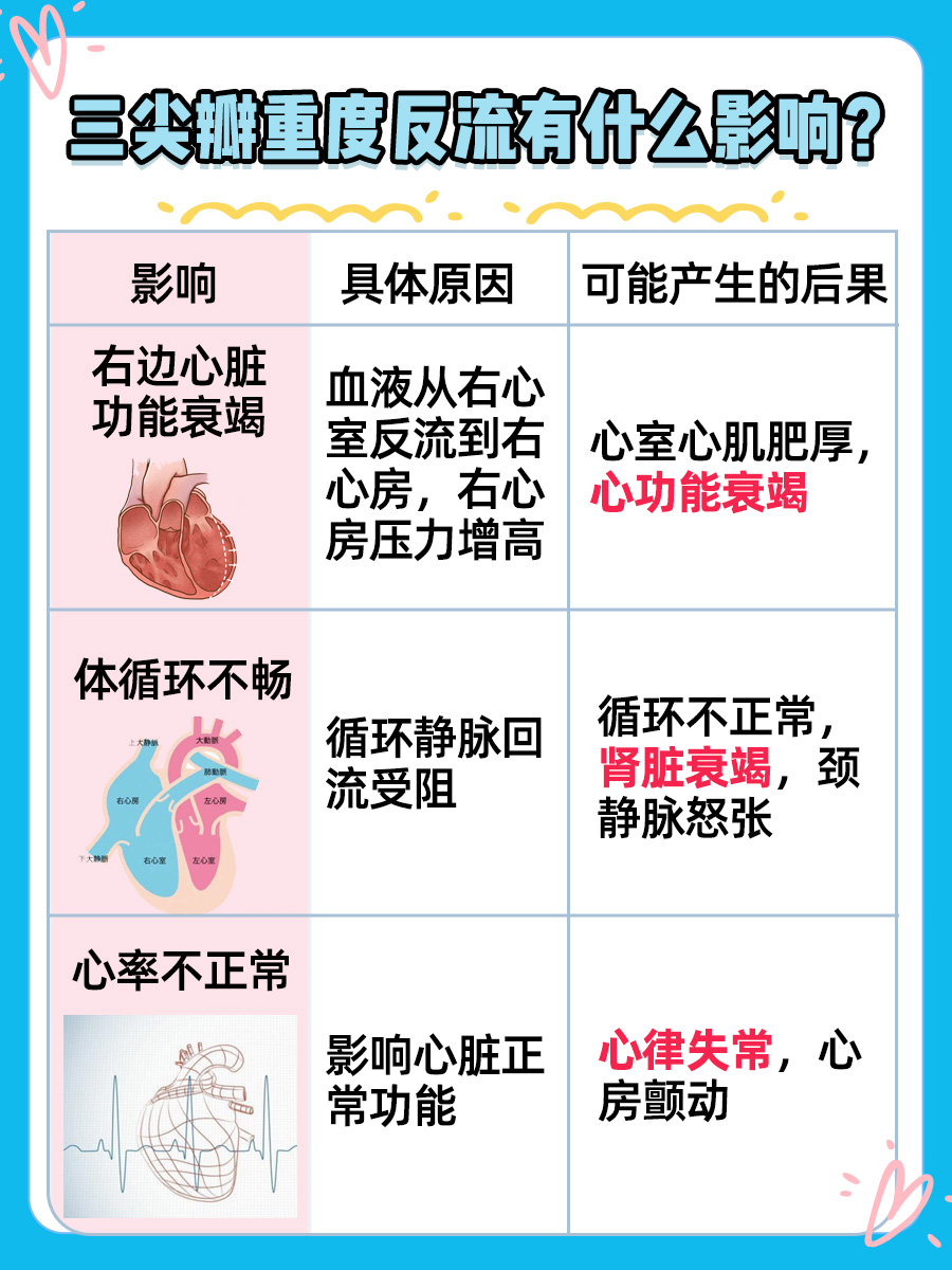 三尖瓣重度反流,其影响大揭秘