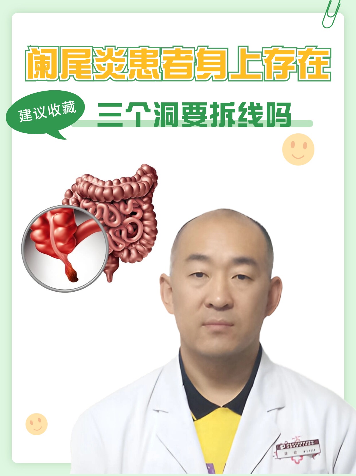 阑尾炎手术三处切口，需要拆线吗？