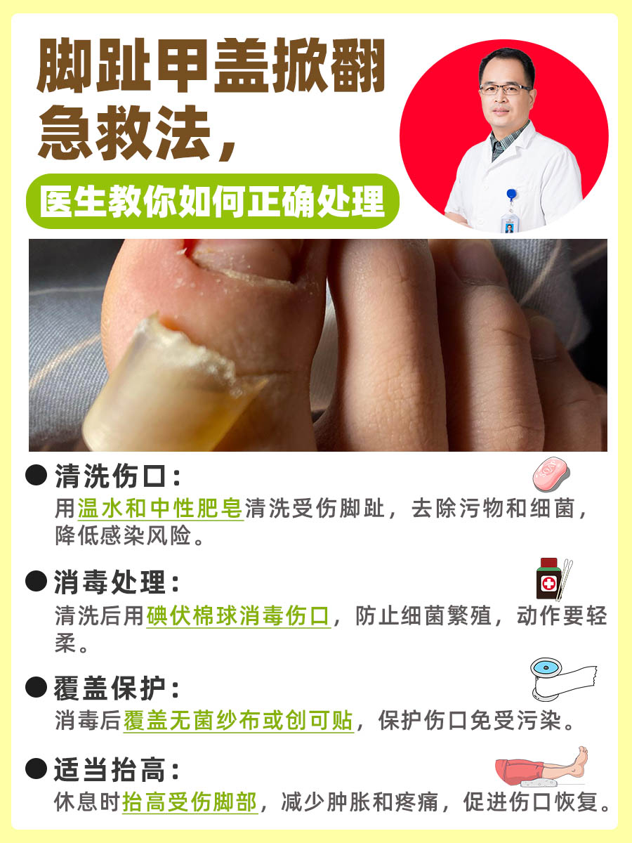 脚趾甲盖掀翻急救法，医生教你如何正确处理