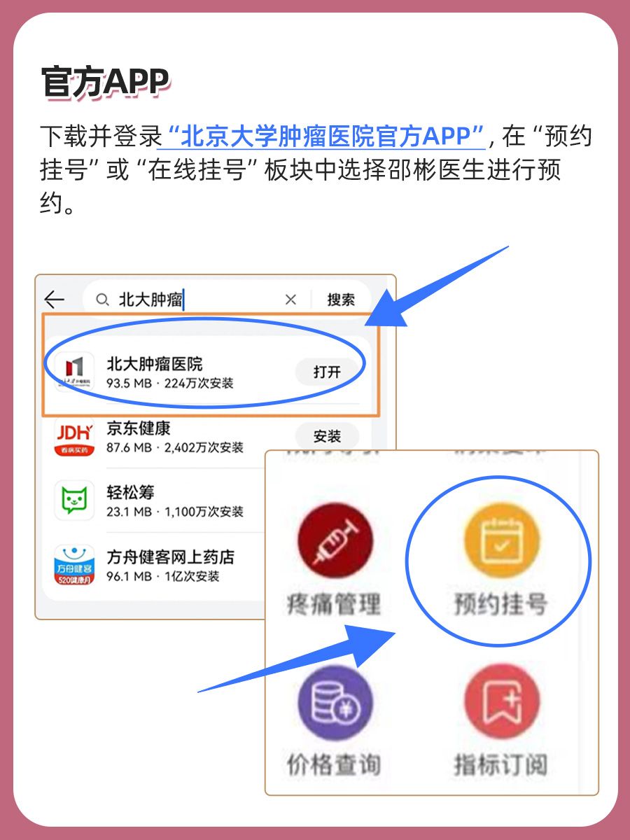 北京大学肿瘤医院邵彬医生怎么样?怎么挂号?