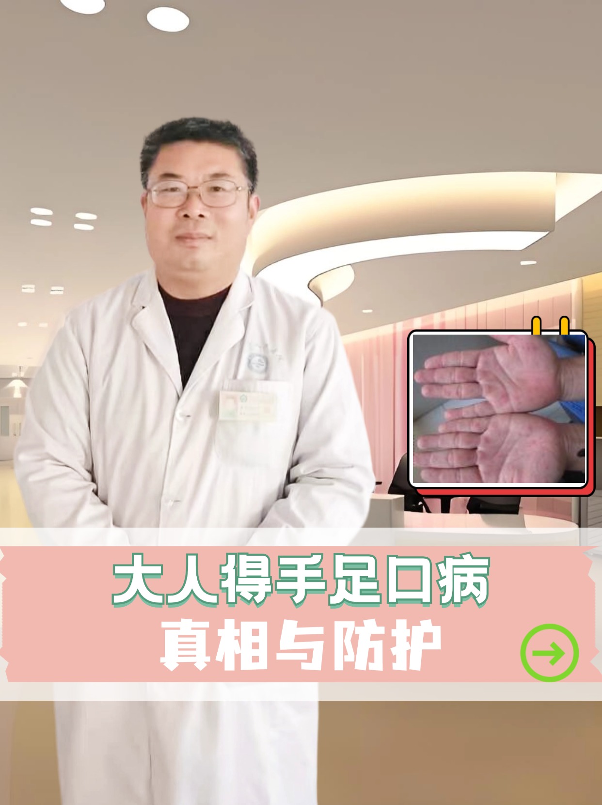 大人得手足口病,真相与防护