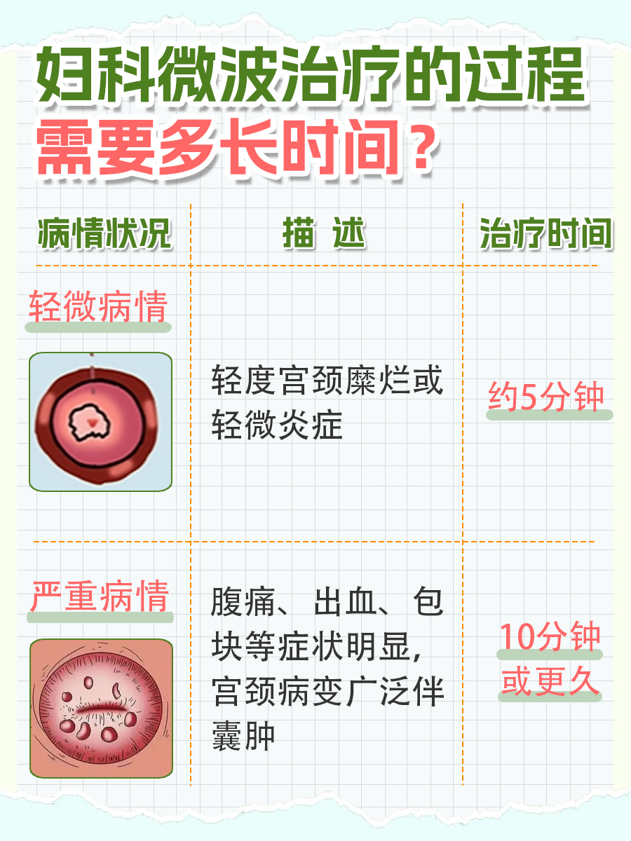 妇科微波治疗过程图片