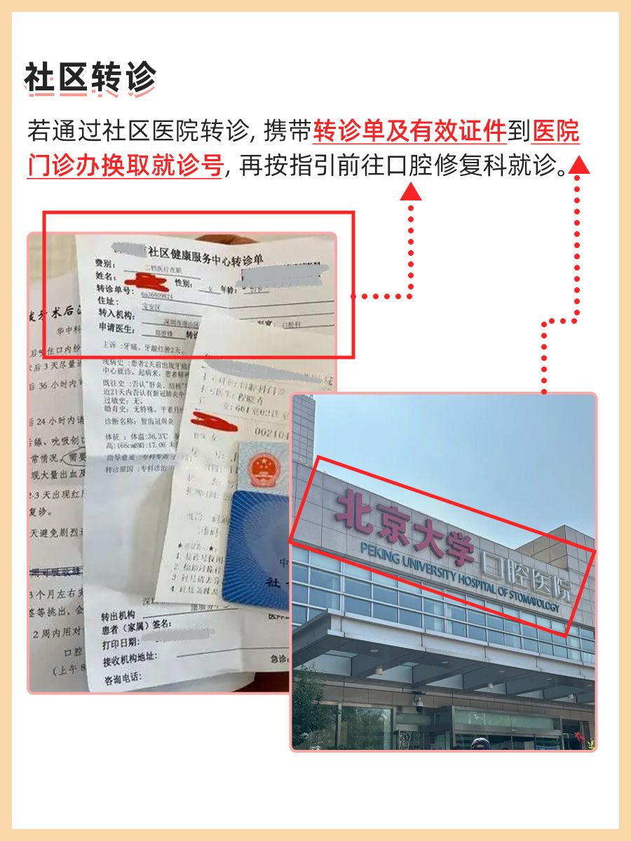 北京大学口腔医院杨静文医生怎么样？怎么挂号？