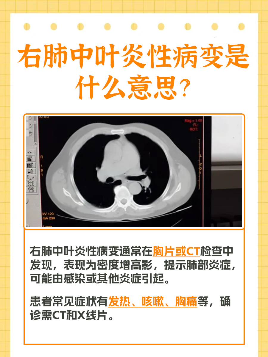 不懂就问：右肺中叶的炎性病变是啥？