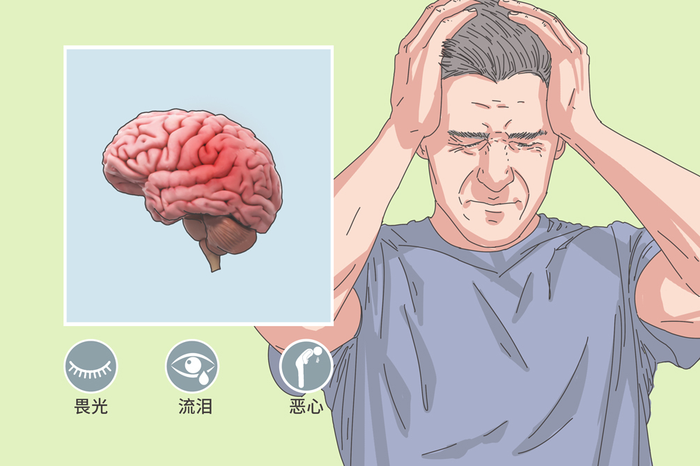 间歇性头痛,间歇性头痛的原因