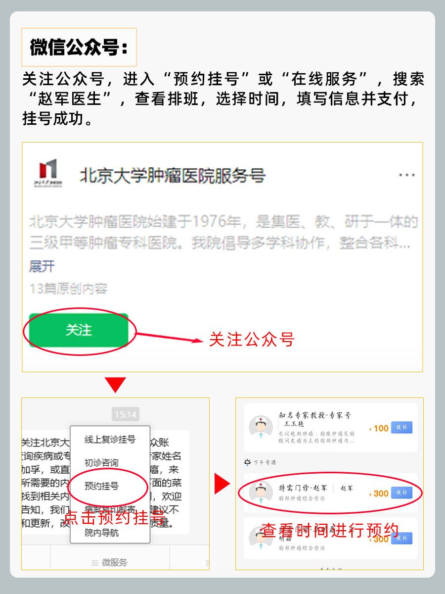 北京肿瘤医院赵军医生怎么样？怎么挂号？