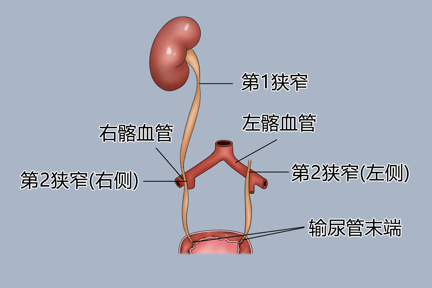 输尿管末端位置图