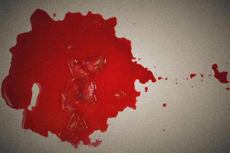 儿童血热吐血图 儿童血热吐血图