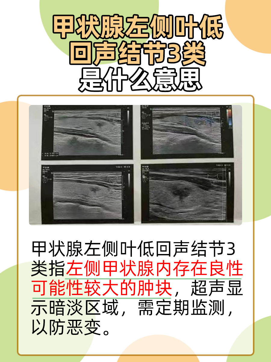 甲状腺左侧叶低回声结节3类是什么意思？揭秘
