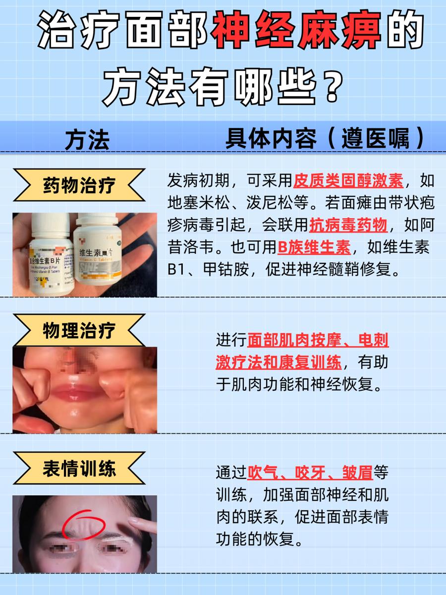 探究：面部神经麻痹的治疗方法