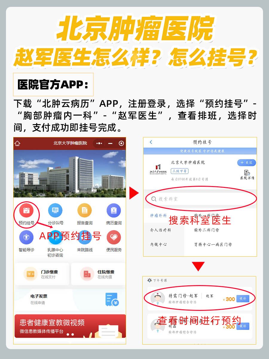 北京肿瘤医院赵军医生怎么样？怎么挂号？