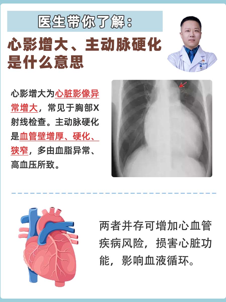 医生带你了解：心影增大、主动脉硬化是什么意思