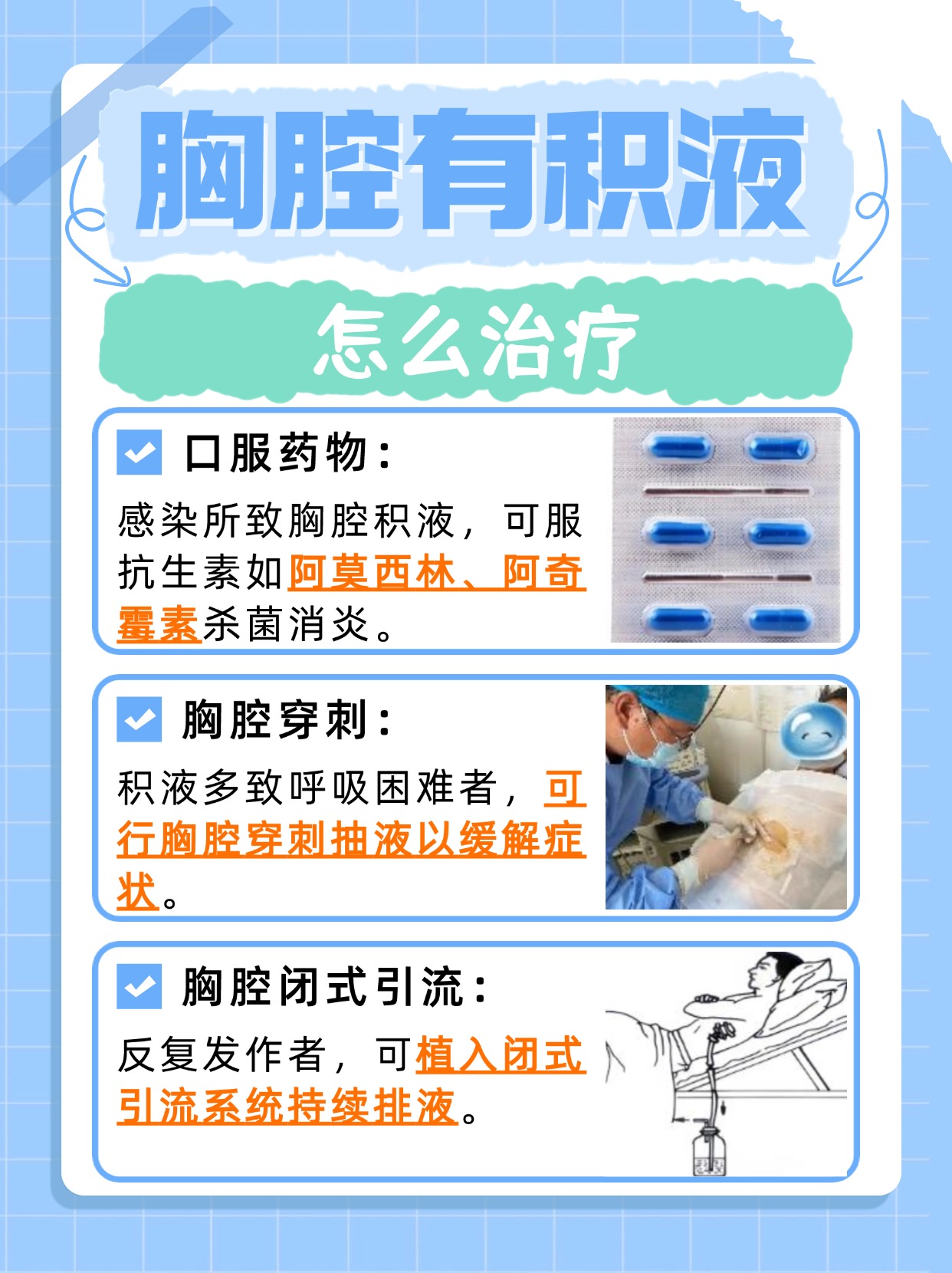 胸腔有积液，轻松帮你搞定