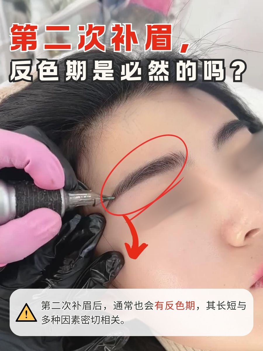 第二次补眉,反色期是必然的吗?