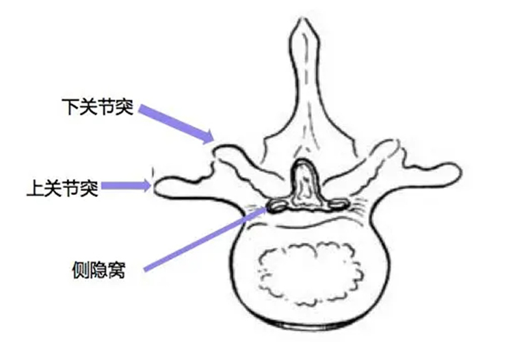 腰椎侧隐窝位置图 腰椎侧隐窝位置图