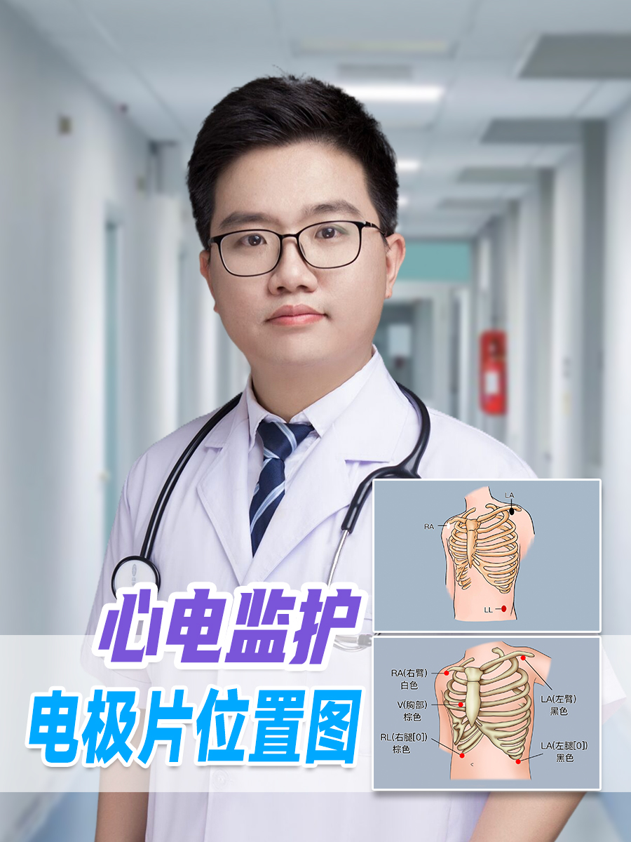 心电监护电极片位置图