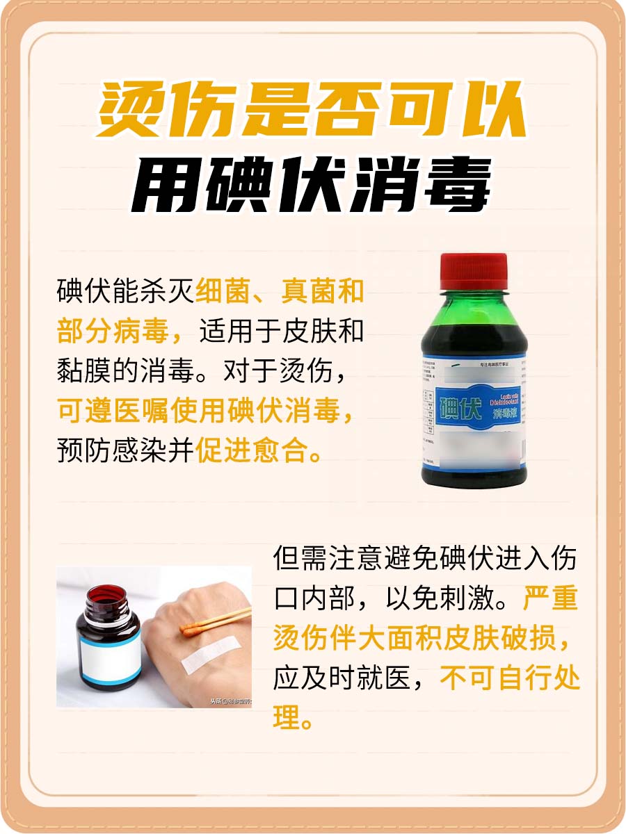 烫伤是否可以用碘伏消毒?一篇文章带你了解