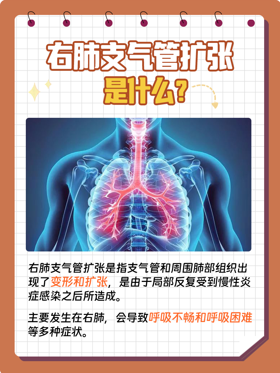 右肺支气管扩张,你知道这是什么吗?