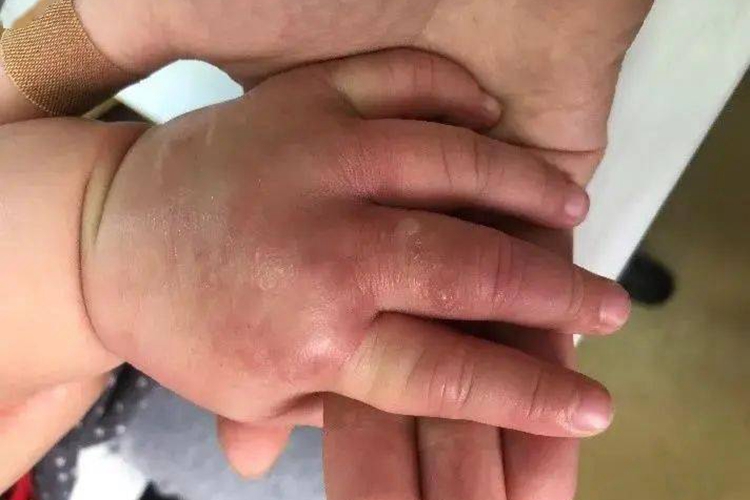 小孩子玩起泡胶手烂图 小孩子玩起泡胶手烂图