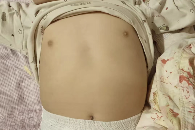 婴儿正常肋骨图