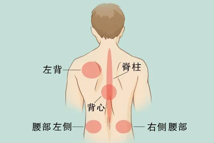 后背疼痛分布图