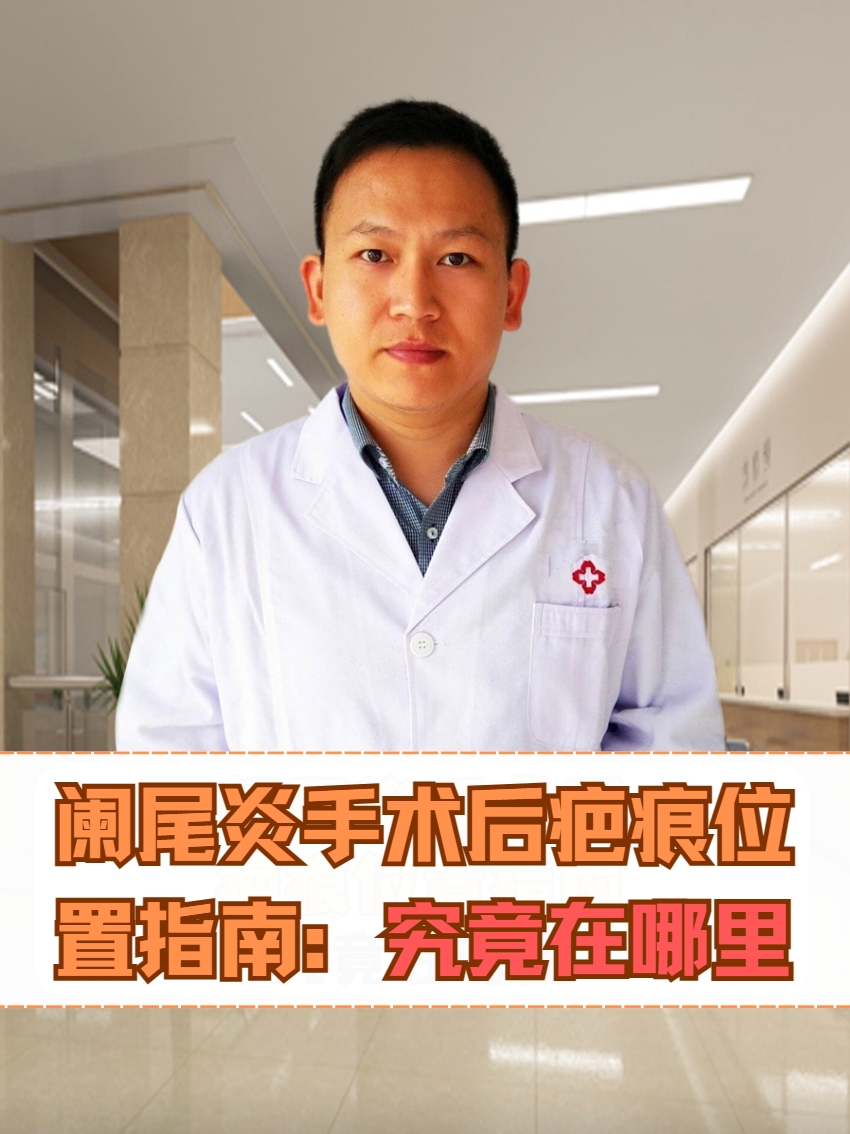 阑尾炎手术后疤痕位置指南：究竟在哪里