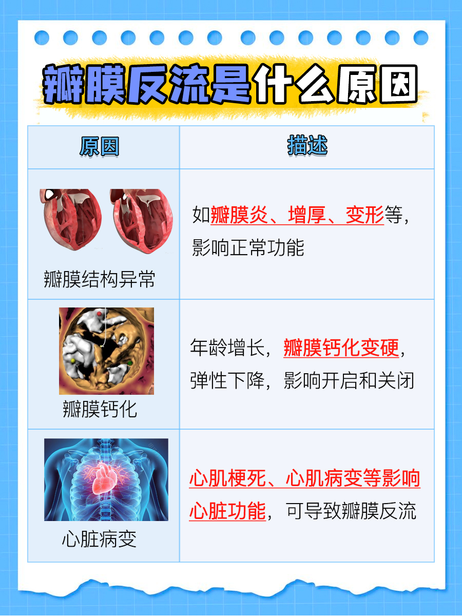 瓣膜反流的成因:关注心脏瓣膜疾病