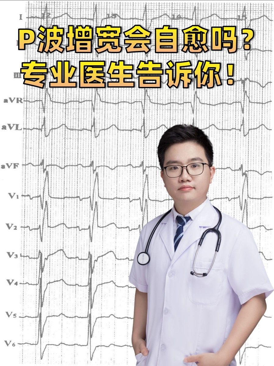 P波增宽会自愈吗？专业医生告诉你！