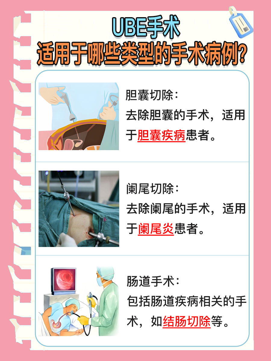 UBE手术是什么？带你了解微创技术！