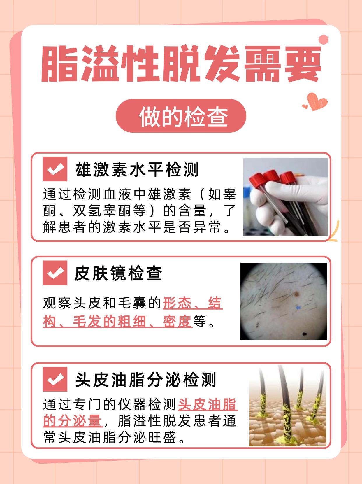 脂溢性脱发能治好吗？答案来了