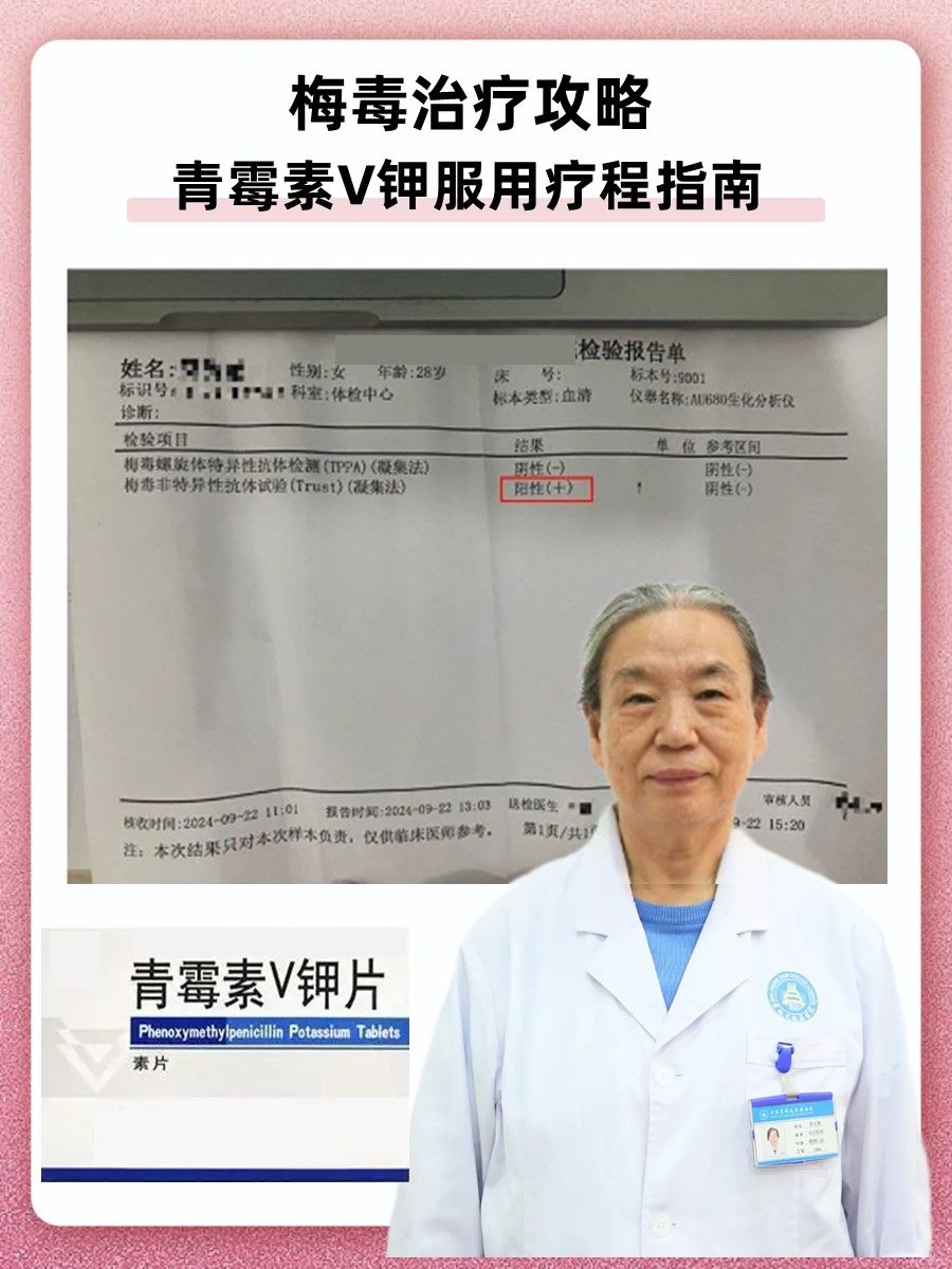 梅毒治疗攻略：青霉素V钾的服用疗程