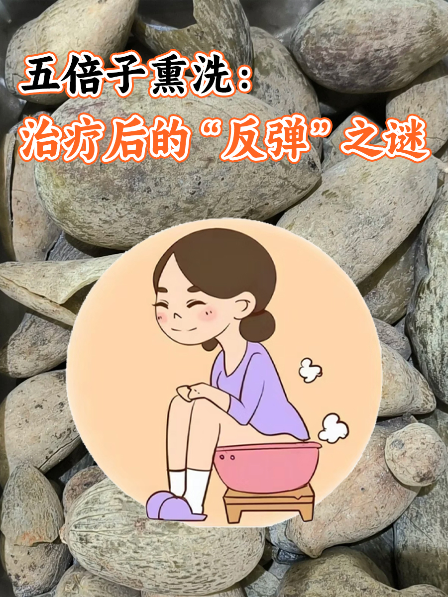 五倍子熏洗：治疗后的“反弹”之谜