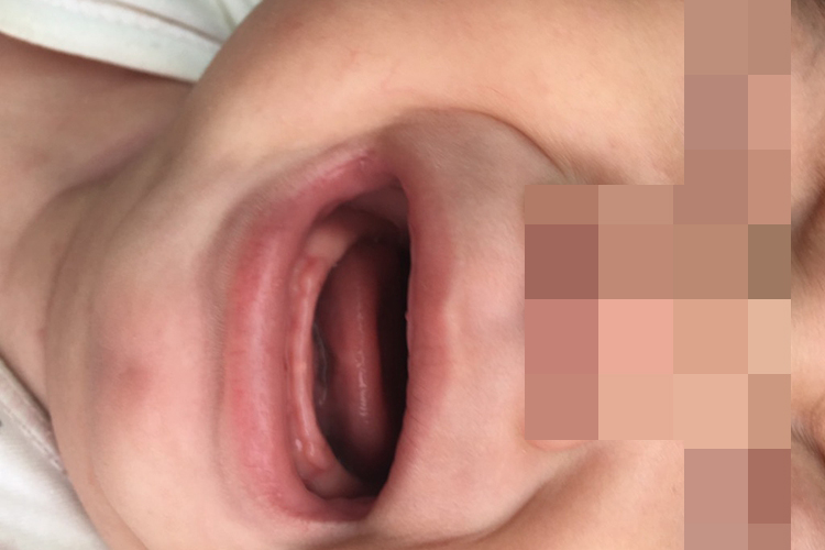 要长牙的牙龈图