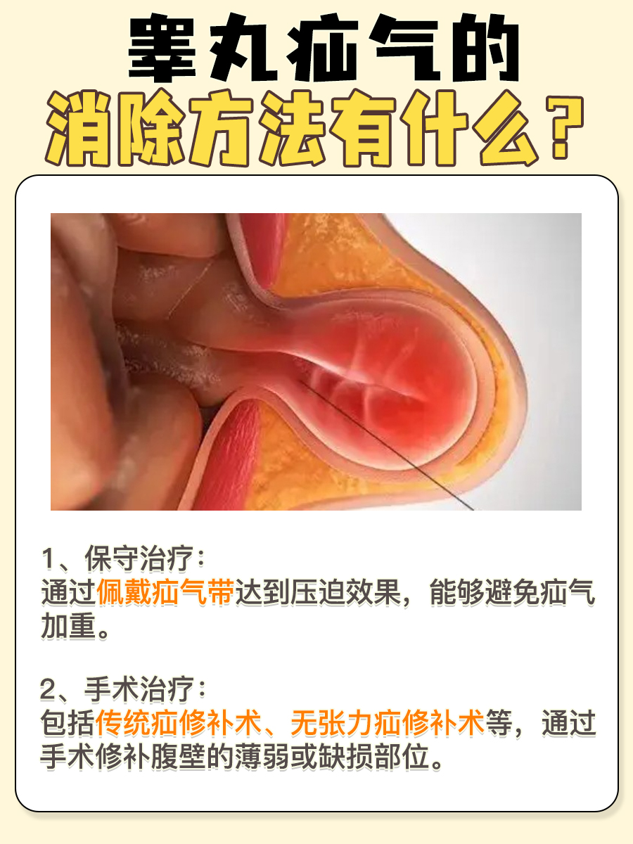 睾丸疝气有最简单的消除方法？专家辟谣来了