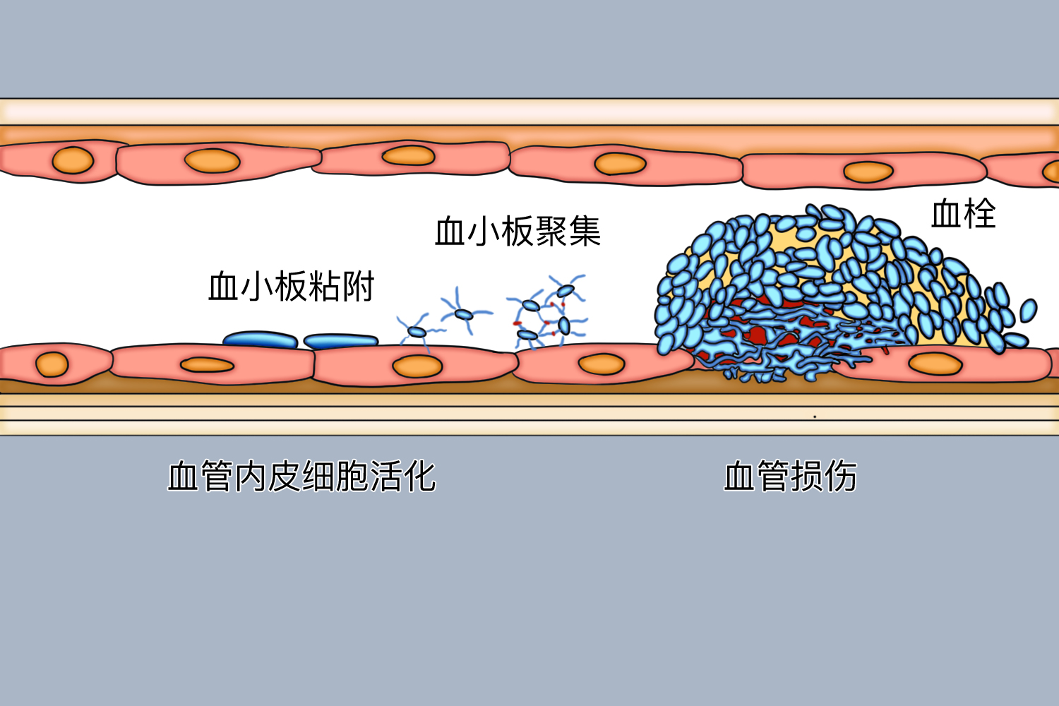 血小板聚集过程图