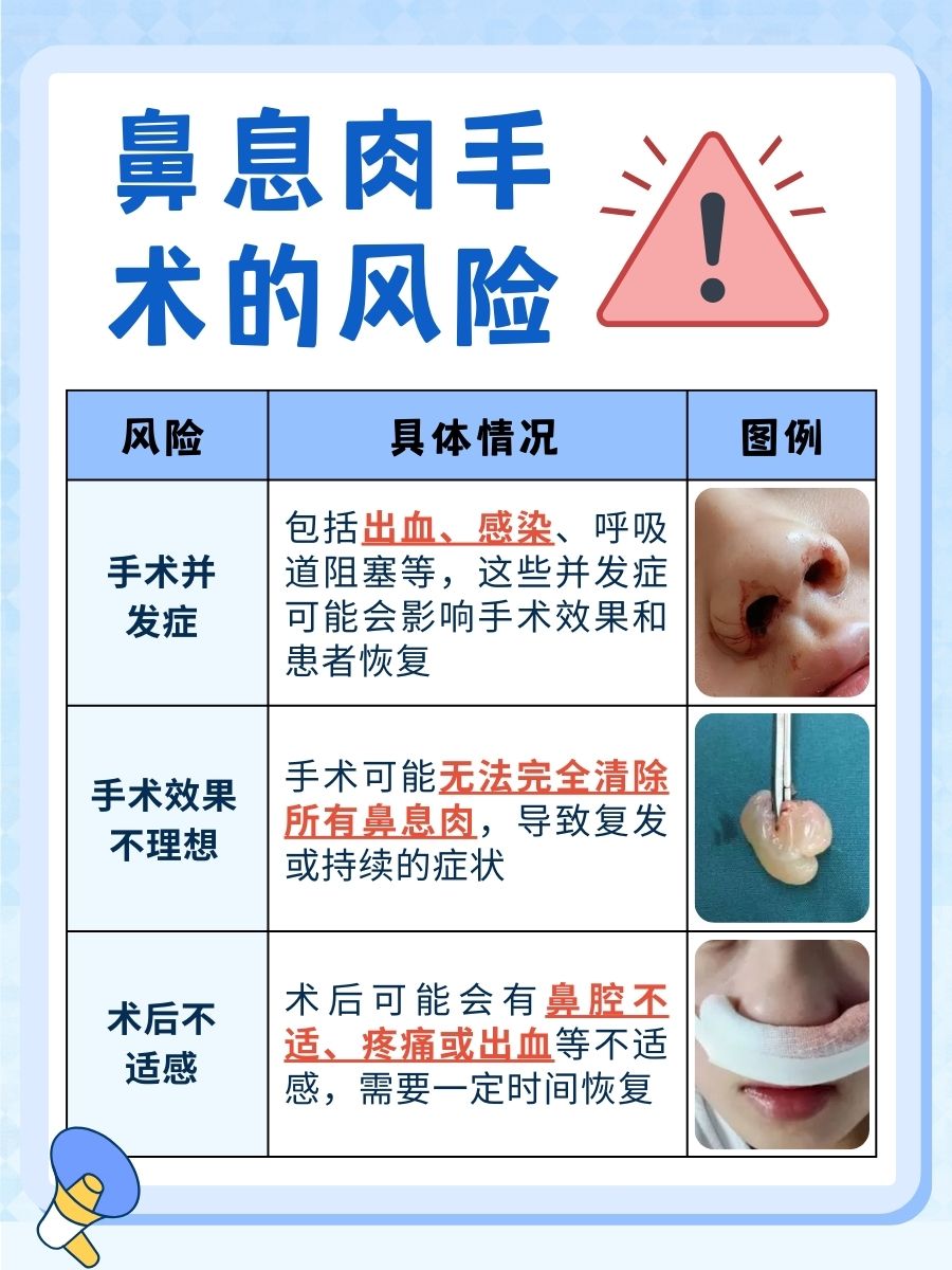 鼻息肉手术，费用问题你必须知道