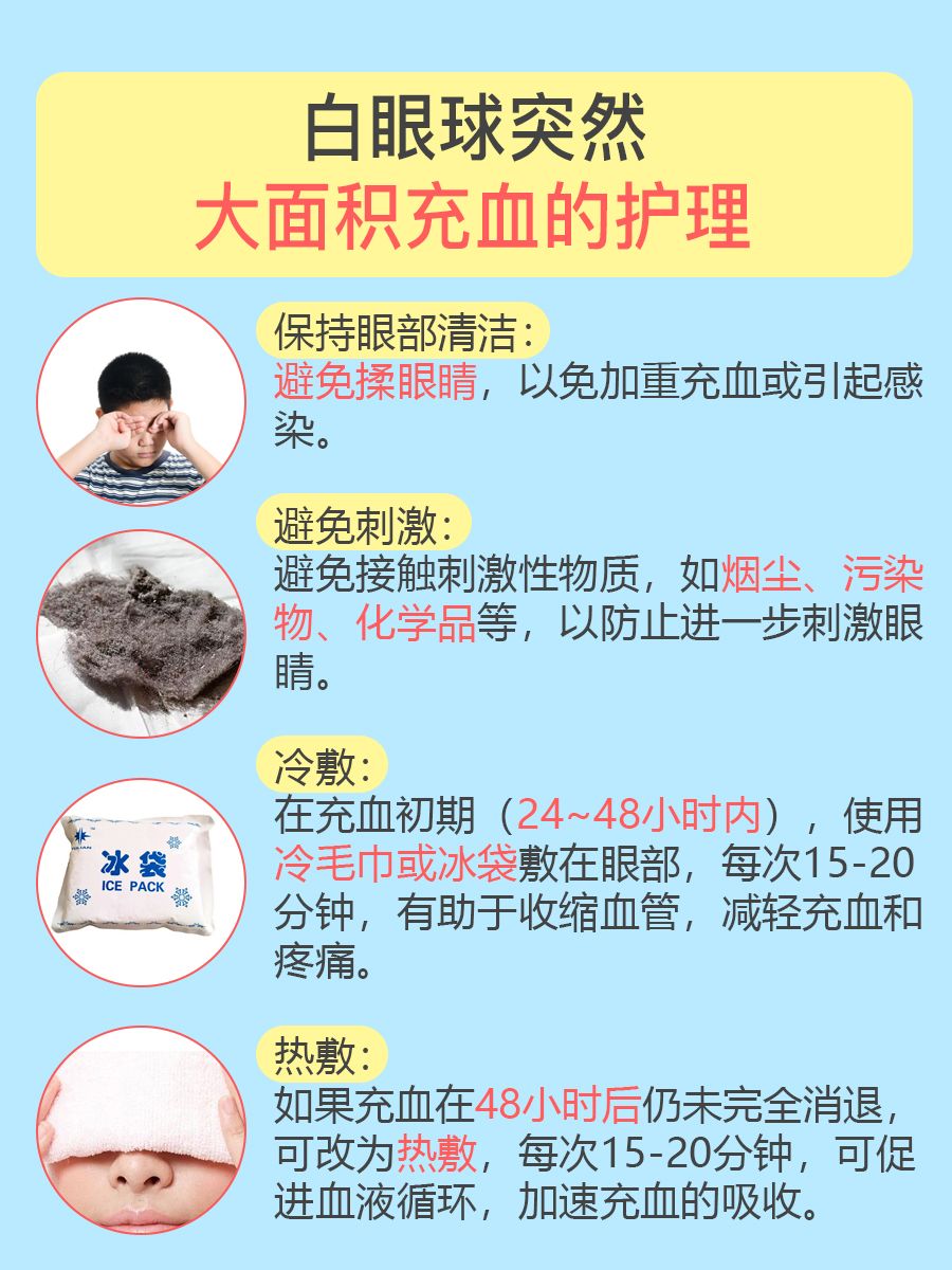 突发白眼球大充血!原因+处理“一网打尽”