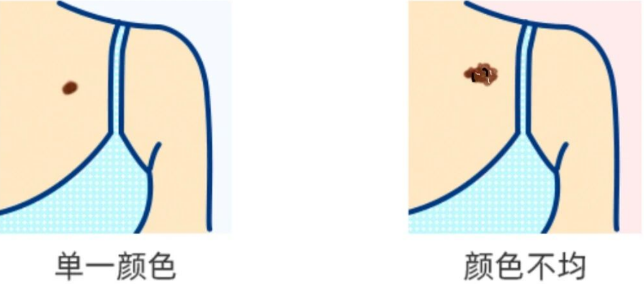 48ff8a1c-3342-48cf-90fe-8c706b1b0a5e.png